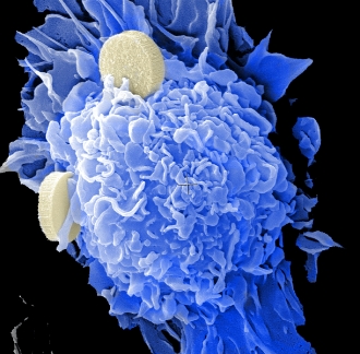 national-cancer-institute-gyGyIEeikSw-unsplash